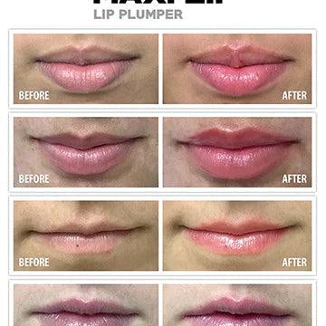 Maxi Lip Plumper - Vivant - Albany Aesthetics